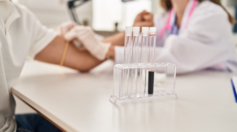 Exames laboratoriais ajudam a identificar doenças silenciosas antes dos primeiros sintomas